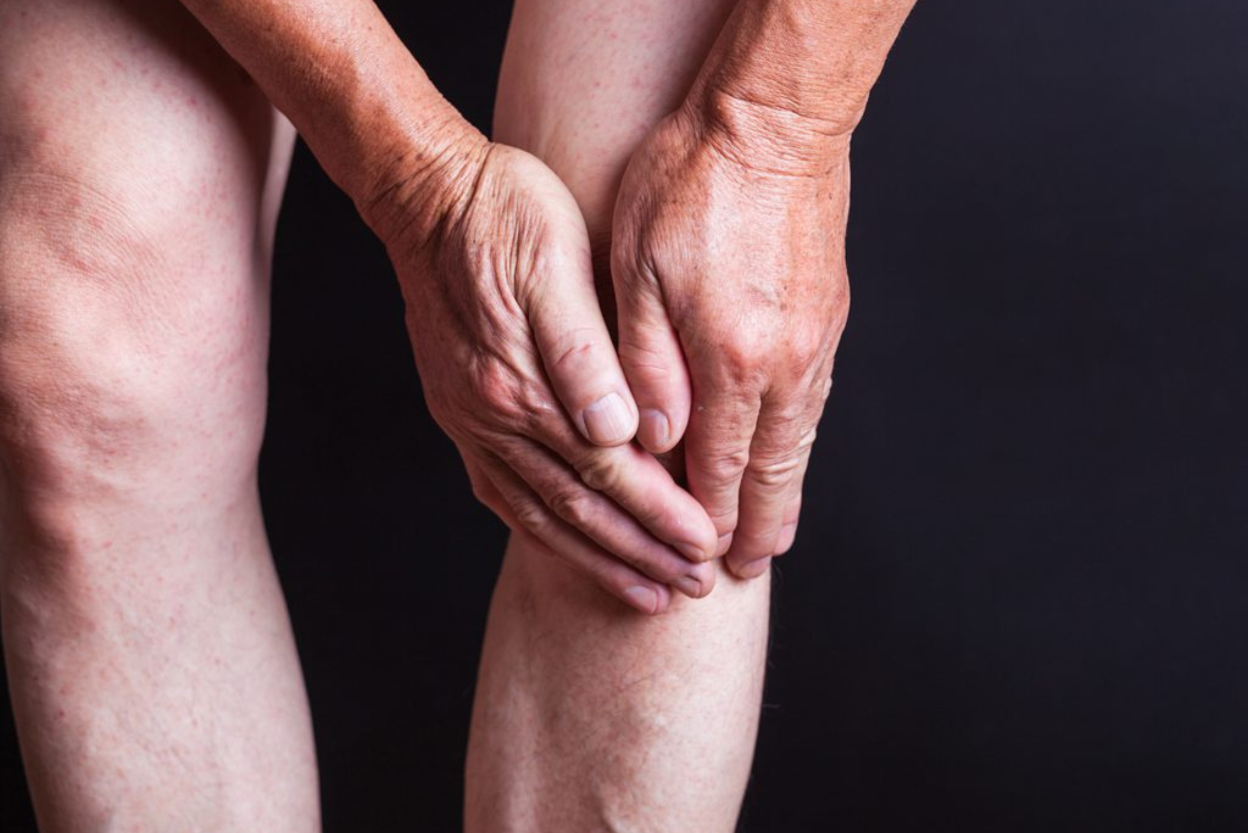viscosupplementation injections