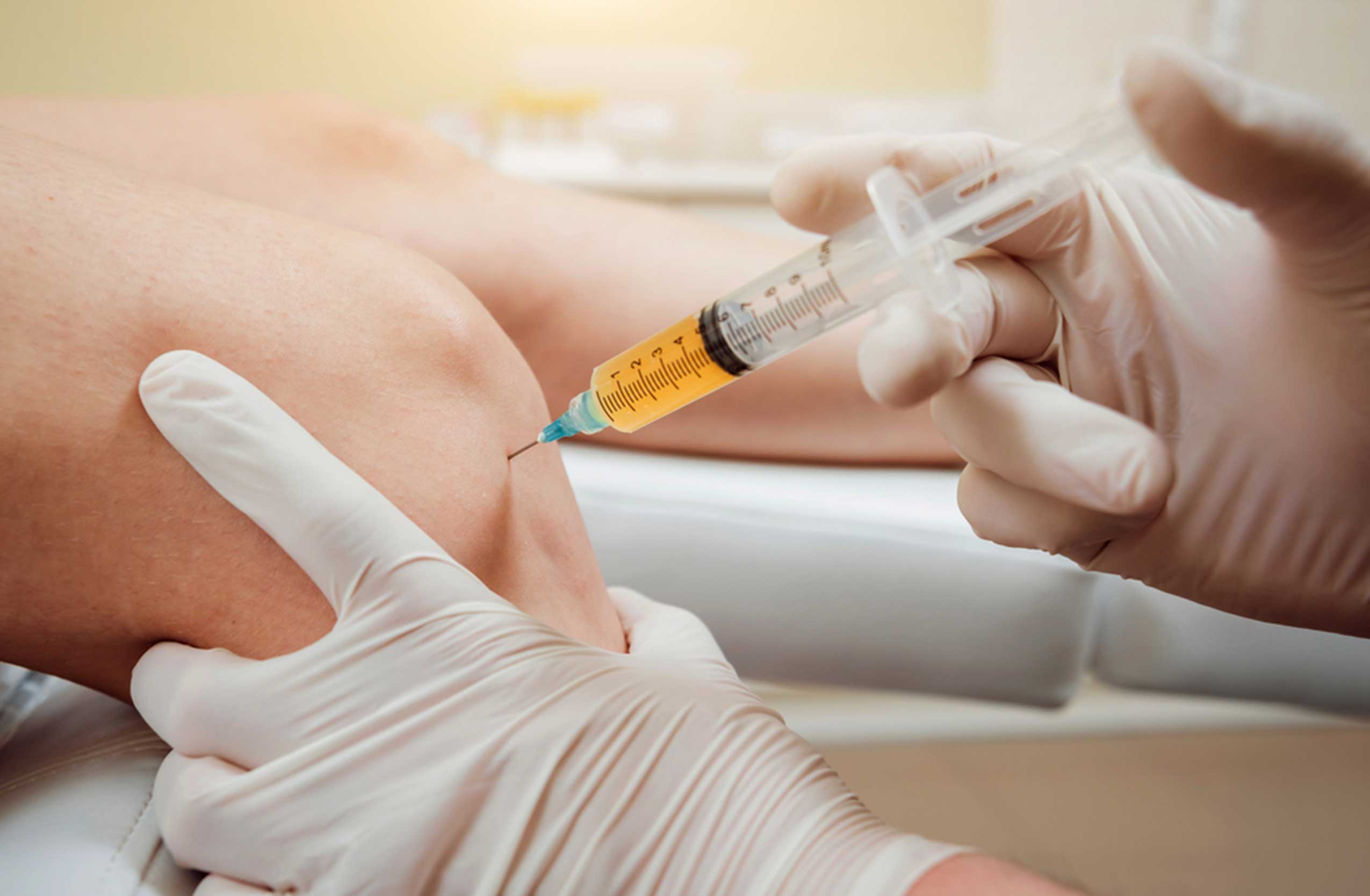 Knee Injections (Part 2) – Viscosupplementation Injections