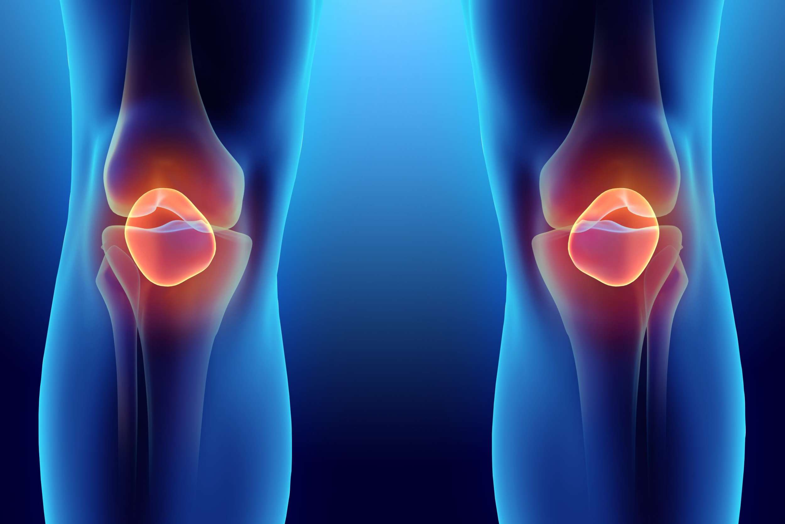 Patella Alta vs Patella Baja: Causes, Symptoms, Treatment & Recovery