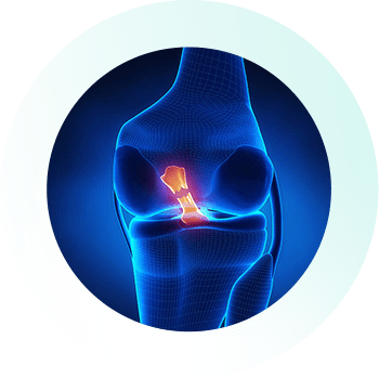 Is ACL Repair Viable as a Method of Treating ACL Injury?