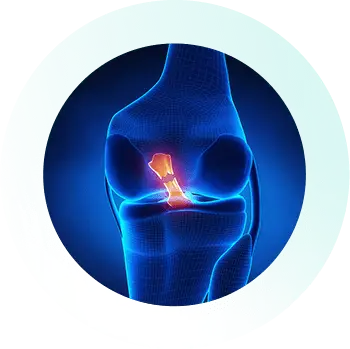 https://orthokinetics.sg/wp-content/uploads/2025/09/Knee_Specialist_Services_ACL.webp