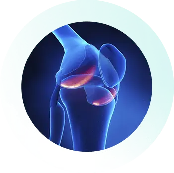 https://orthokinetics.sg/wp-content/uploads/2025/09/Knee_Specialist_Services_ACL_Osteoarthritis.webp