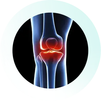 https://orthokinetics.sg/wp-content/uploads/2025/09/Knee_Specialist_Services_Osteochondritis-Dissecans.webp