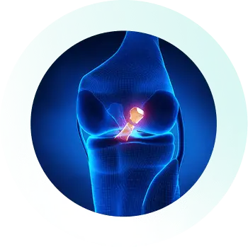 https://orthokinetics.sg/wp-content/uploads/2025/09/Knee_Specialist_Services_PCL.webp
