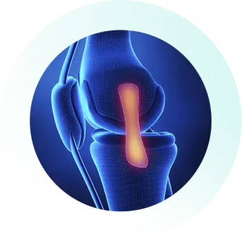 https://orthokinetics.sg/wp-content/uploads/2025/09/Knee_Specialist_Services_Patella-Dislocation.webp