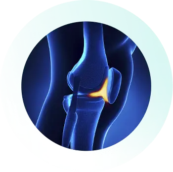 https://orthokinetics.sg/wp-content/uploads/2025/09/Knee_Specialist_Services_Patellar-Tendinitis.webp