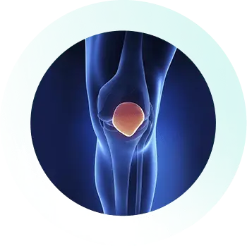 https://orthokinetics.sg/wp-content/uploads/2025/09/Knee_Specialist_Services_Pes-Anserine-Bursitis.webp