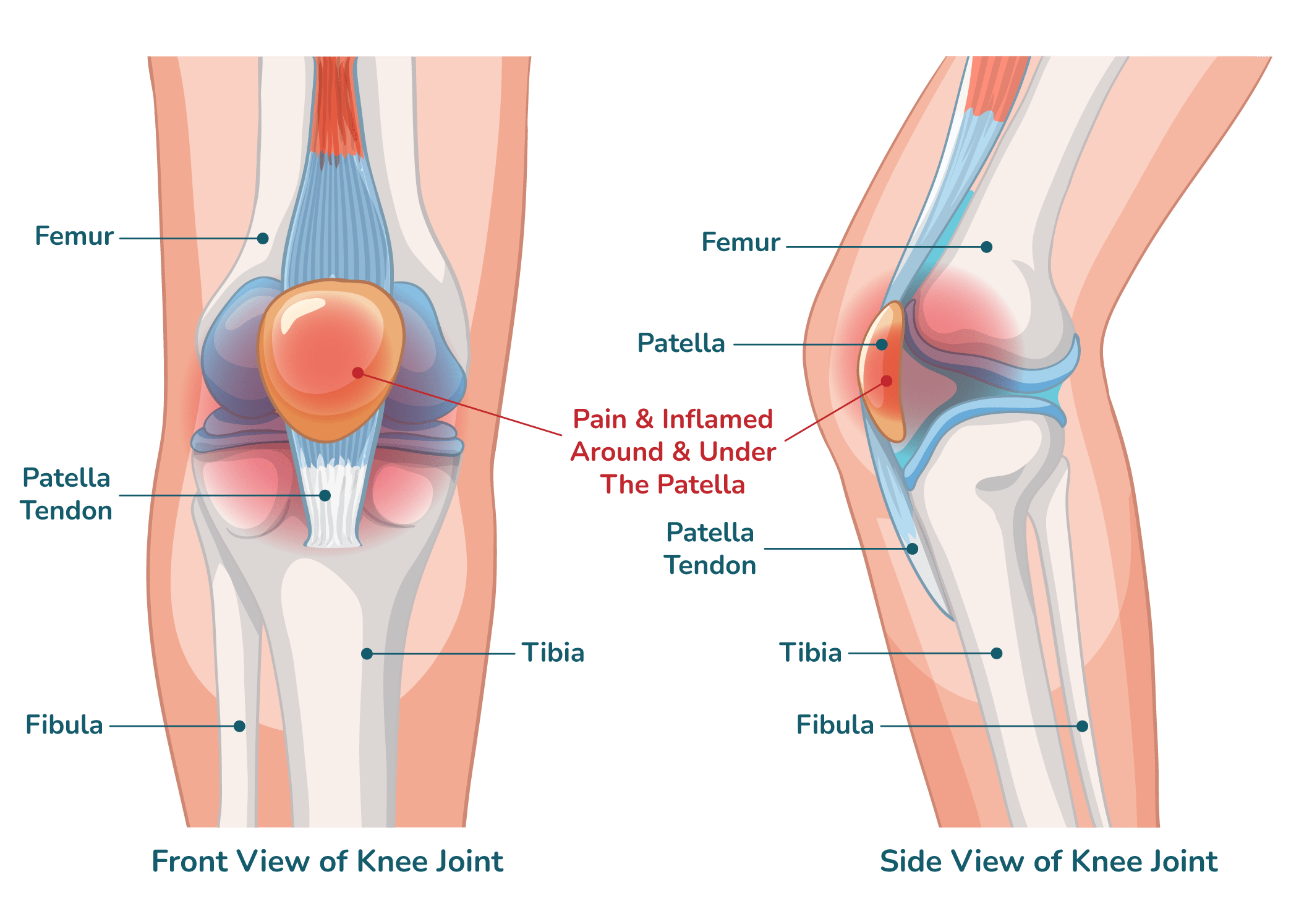 https://orthokinetics.sg/wp-content/uploads/2025/09/image_OrthoKinetics_KneeCap-min.png