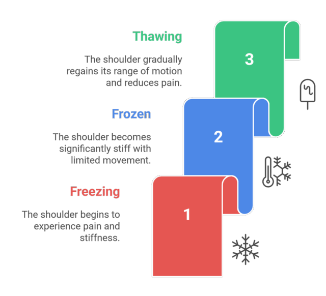 Frozenshoulder_diagram https://orthokinetics.sg/wp-content/uploads/2025/11/Frozenshoulder_diagram-640x582.png